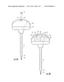 Instrument For Concurrent Injection Of Anesthesia And Removal Of Specimens     From A Body diagram and image