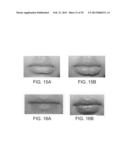 LIP ENHANCEMENT AND ENLARGEMENT DEVICE diagram and image