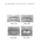 LIP ENHANCEMENT AND ENLARGEMENT DEVICE diagram and image