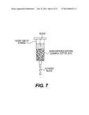 IMMUNOACTIVATION BLOOD PERFUSION FILTER FOR THE TREATMENT OF MALIGNANT     TUMORS diagram and image