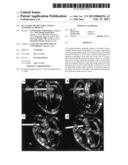 OCCLUSION DEVICE FOR CLOSING ANATOMICAL DEFECTS diagram and image