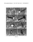 OCCLUSION DEVICE FOR CLOSING ANATOMICAL DEFECTS diagram and image