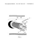 ABLATION APPARATUS AND SYSTEM TO LIMIT NERVE CONDUCTION diagram and image