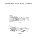 ABLATION APPARATUS AND SYSTEM TO LIMIT NERVE CONDUCTION diagram and image