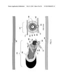 ABLATION APPARATUS AND SYSTEM TO LIMIT NERVE CONDUCTION diagram and image