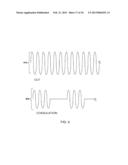 ABLATION APPARATUS AND SYSTEM TO LIMIT NERVE CONDUCTION diagram and image