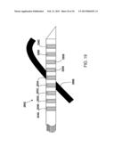 ABLATION APPARATUS AND SYSTEM TO LIMIT NERVE CONDUCTION diagram and image