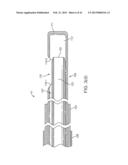 TISSUE REMOVAL SYSTEM diagram and image