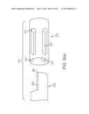 TISSUE REMOVAL SYSTEM diagram and image