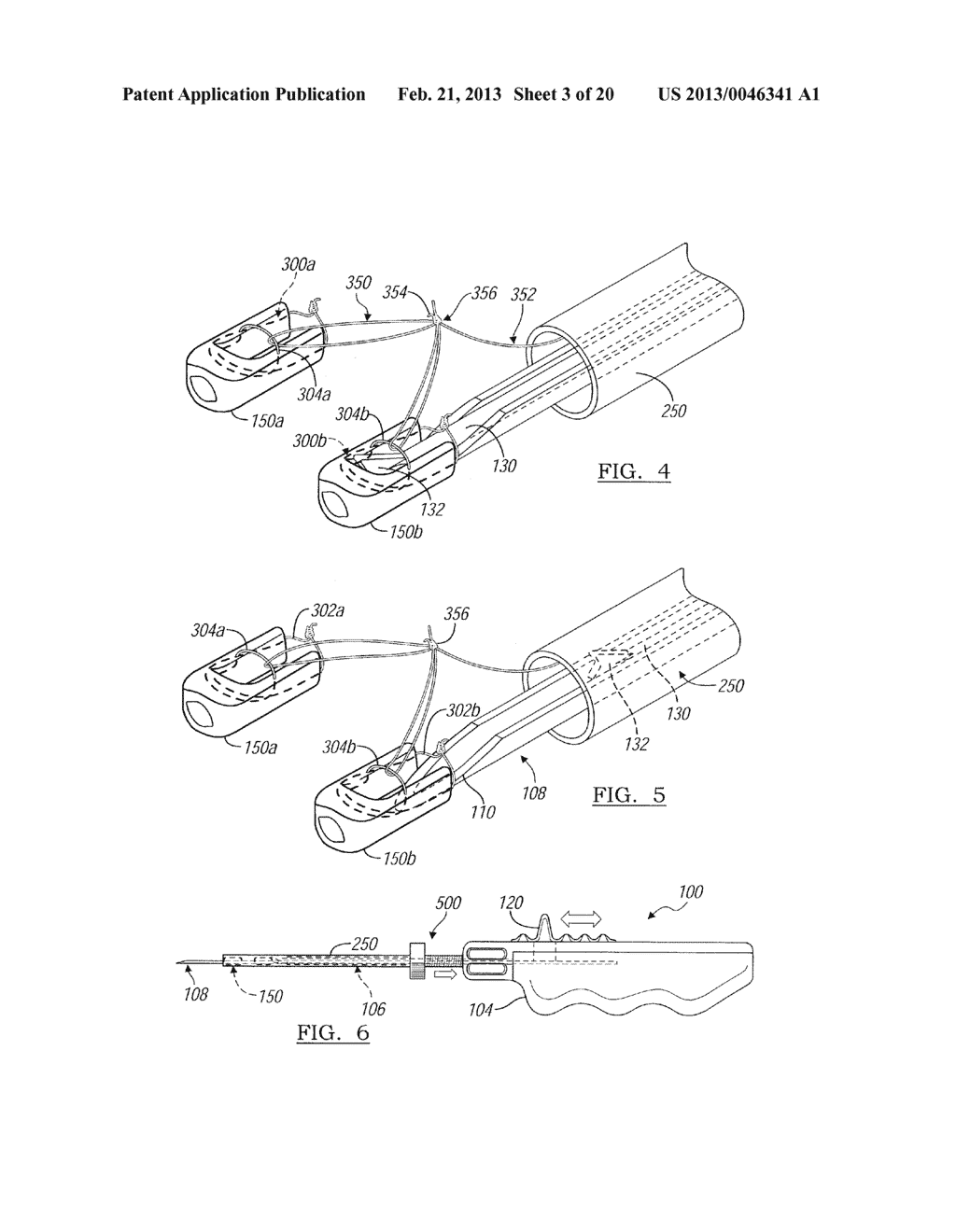 Soft Tissue Repair Device And Associated Methods - diagram, schematic, and image 04