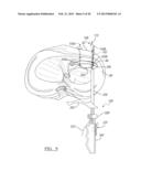 Soft Tissue Repair Device And Associated Methods diagram and image