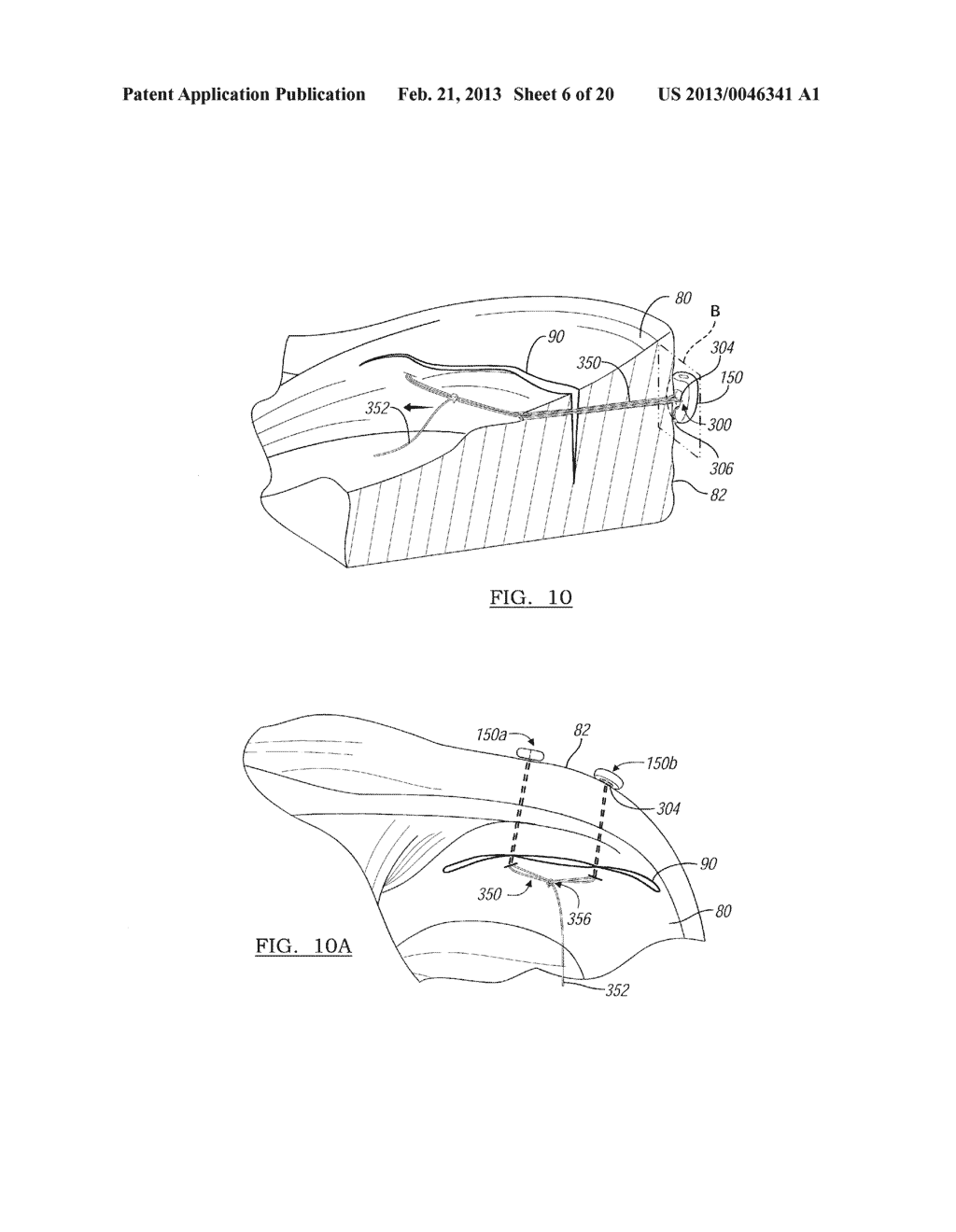 Soft Tissue Repair Device And Associated Methods - diagram, schematic, and image 07