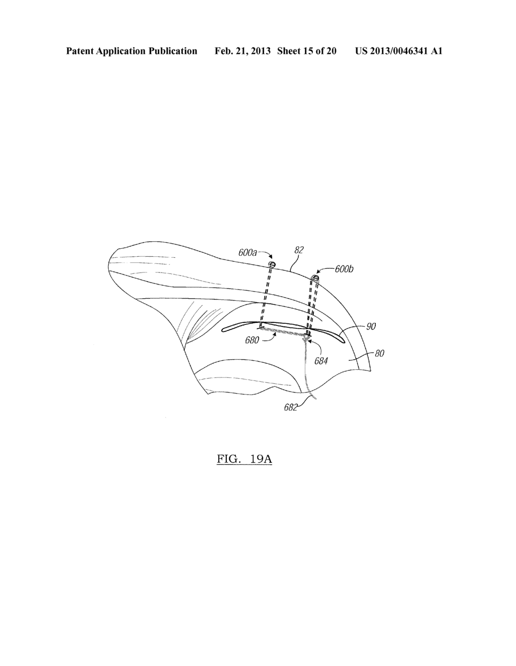 Soft Tissue Repair Device And Associated Methods - diagram, schematic, and image 16