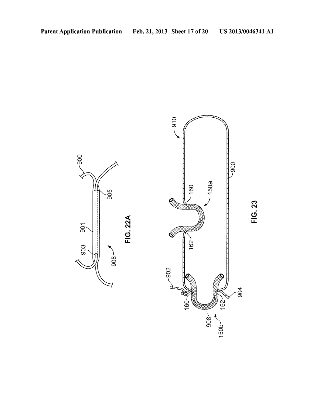 Soft Tissue Repair Device And Associated Methods - diagram, schematic, and image 18