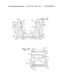 Polyaxial bone anchor with pop-on shank, shank, friction fit retainer,     winged insert and low profile edge lock diagram and image