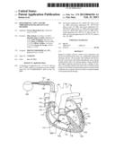 HIGH PHRENIC, LOW CAPTURE THRESHOLD PACING DEVICES AND METHODS diagram and image