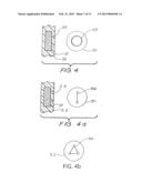 IMPLANT MAGNET SYSTEM diagram and image