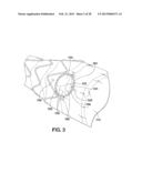 ENDOLUMINAL PROSTHESIS HAVING MULTIPLE BRANCHES OR FENESTRATIONS AND     METHODS OF DEPLOYMENT diagram and image