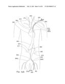 ENDOLUMINAL PROSTHESIS HAVING MULTIPLE BRANCHES OR FENESTRATIONS AND     METHODS OF DEPLOYMENT diagram and image