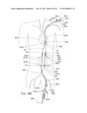 ENDOLUMINAL PROSTHESIS HAVING MULTIPLE BRANCHES OR FENESTRATIONS AND     METHODS OF DEPLOYMENT diagram and image