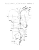 ENDOLUMINAL PROSTHESIS HAVING MULTIPLE BRANCHES OR FENESTRATIONS AND     METHODS OF DEPLOYMENT diagram and image