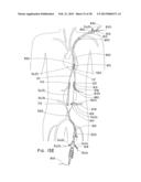 ENDOLUMINAL PROSTHESIS HAVING MULTIPLE BRANCHES OR FENESTRATIONS AND     METHODS OF DEPLOYMENT diagram and image