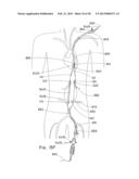 ENDOLUMINAL PROSTHESIS HAVING MULTIPLE BRANCHES OR FENESTRATIONS AND     METHODS OF DEPLOYMENT diagram and image