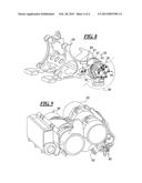 Radial Mounting for Regeneration Device diagram and image