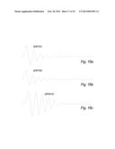 Ultrasonic Flow Meter diagram and image