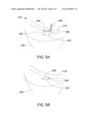 Wearable Apparatus for Dispensing a Beverage diagram and image