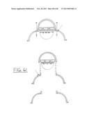 Lighting system and method of deflection diagram and image