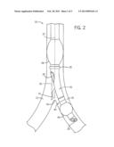 TRACHEAL TUBE WITH VISUALIZATION DEVICE AND INTEGRATED FLUSHING SYSTEM diagram and image