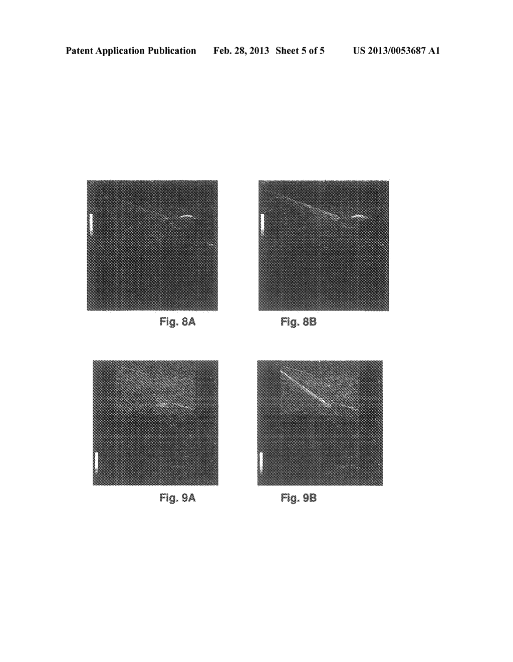 METHOD, APPARATUS AND SYSTEM FOR ENHANCING NEEDLE VISUALIZATION IN MEDICAL     ULTRASOUND IMAGING - diagram, schematic, and image 06