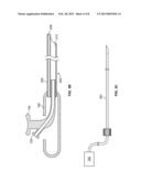 BLOOD VESSEL SENSING CATHETER HAVING WORKING LUMEN FOR MEDICAL APPLIANCES diagram and image