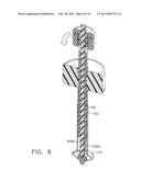 Surgical Access Device with Adjustable Cannula diagram and image