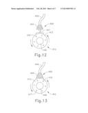 IMPLANTABLE MEDICAL PORT WITH ALIGNMENT FEATURE diagram and image