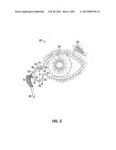 SUSTAINED RELEASE DELIVERY OF ACTIVE AGENTS TO TREAT GLAUCOMA AND OCULAR     HYPERTENSION diagram and image