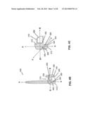 SUSTAINED RELEASE DELIVERY OF ACTIVE AGENTS TO TREAT GLAUCOMA AND OCULAR     HYPERTENSION diagram and image