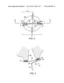 ABLATION CATHETER FOR VEIN ANATOMIES diagram and image