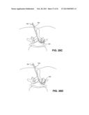 DEVICES, METHODS AND SYSTEMS FOR NEURAL LOCALIZATION diagram and image