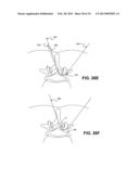 DEVICES, METHODS AND SYSTEMS FOR NEURAL LOCALIZATION diagram and image