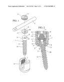 ELONGATED STABILIZATION MEMBER AND BONE ANCHOR USEFUL IN BONE AND     ESPECIALLY SPINAL REPAIR PROCESSES diagram and image