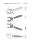 ELONGATED STABILIZATION MEMBER AND BONE ANCHOR USEFUL IN BONE AND     ESPECIALLY SPINAL REPAIR PROCESSES diagram and image