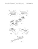 Implant diagram and image