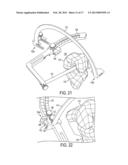 Cross Pinning Guide Devices and Methods diagram and image