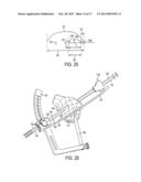 Cross Pinning Guide Devices and Methods diagram and image