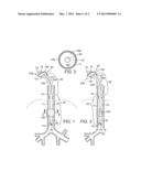 SECRETION CLEARING VENTILATION CATHETER AND AIRWAY MANAGEMENT SYSTEM diagram and image