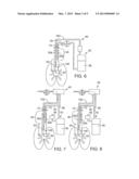 SECRETION CLEARING VENTILATION CATHETER AND AIRWAY MANAGEMENT SYSTEM diagram and image