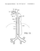 SECRETION CLEARING VENTILATION CATHETER AND AIRWAY MANAGEMENT SYSTEM diagram and image