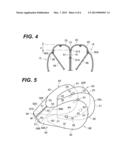 AIRBAG, AIRBAG APPARATUS AND VEHICLE diagram and image